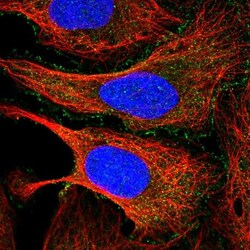 PDCD7 Antibody, Novus Biologicals 0.1mL; Unlabeled:Antibodies, Polyclonal